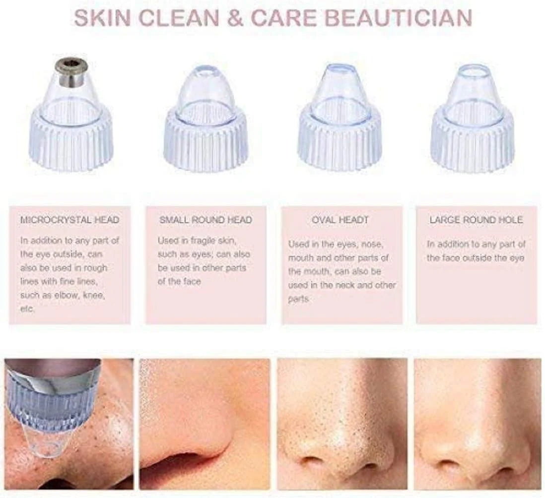 💆‍♀️ Smart Pore Vacuum – Deep Clean, Exfoliate & Refresh Your Skin Instantly