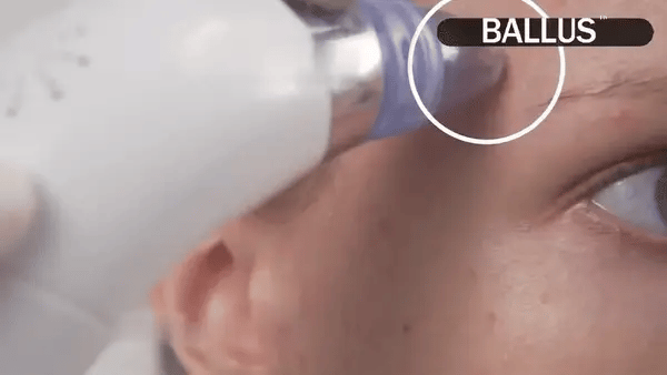 💆‍♀️ Smart Pore Vacuum – Deep Clean, Exfoliate & Refresh Your Skin Instantly